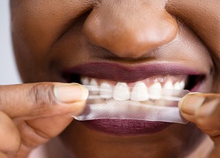 Closeup of woman placing whitening strip over upper arch