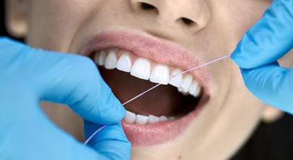 Dental hygienist flossing patient's teeth