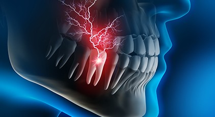 Animated diagram of a toothache in Kernersville