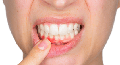 Person pointing to a tooth issue before root canal therapy