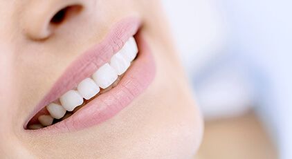 Close up of smile after fluoride treatment
