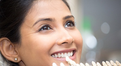 Woman's smile compared to porcelain veneer shade chart