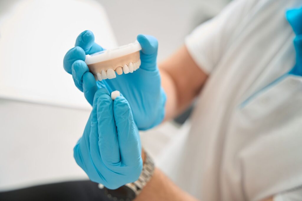 A dentist showing how a dental crown fits onto a tooth